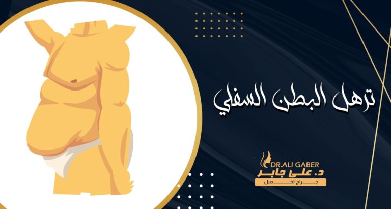 Read more about the article ترهل البطن السفلي | الأسباب والعلاج والتكلفة