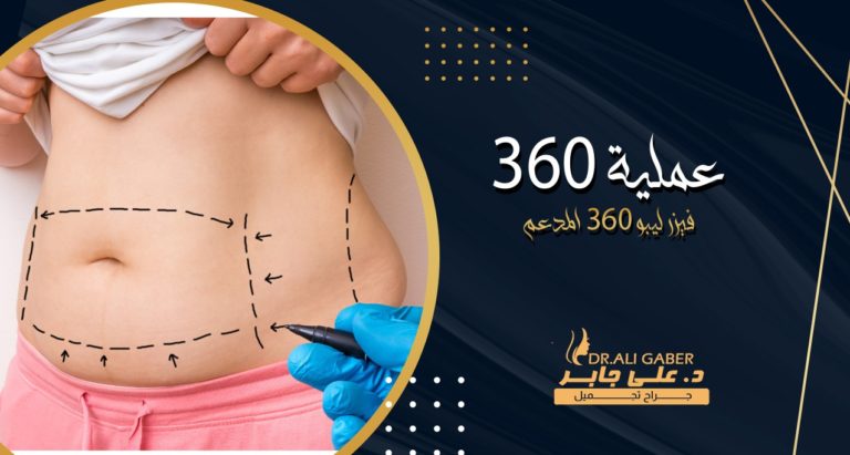 Read more about the article عملية 360 لنحت وشد البطن بالكامل