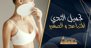 Read more about the article تجميل الثدي المتباعد والصغير