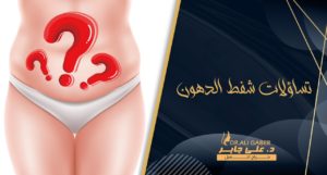 Read more about the article أبرز 30 سؤال حول عملية شفط الدهون