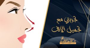 Read more about the article تجربتي مع عملية تجميل الأنف
