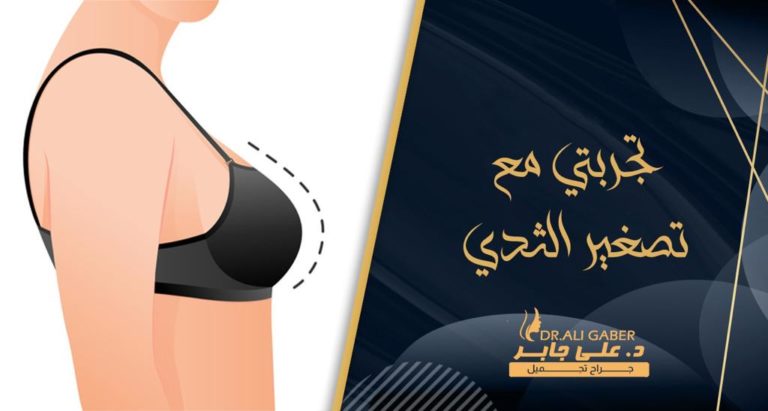 Read more about the article بالتفصيل تجربتي مع عملية تصغير الثدي