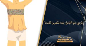 Read more about the article تجربتي مع الترهل بعد تكميم المعدة