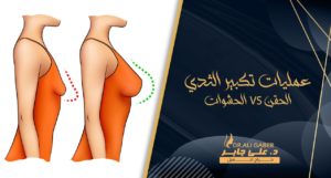 Read more about the article عمليات تكبير الثدي: أيهما أفضل الحشوات أم الحقن