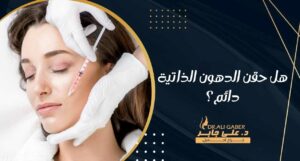 Read more about the article هل حقن الدهون الذاتية دائم؟