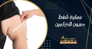 Read more about the article عملية شفط دهون الذراعين