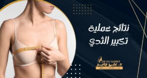 Read more about the article نتائج عملية تكبير الثدي