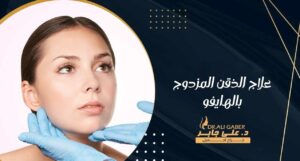 Read more about the article علاج الذقن المزدوج بالهايفو