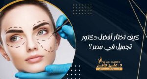 Read more about the article كيف تختار أفضل دكتور تجميل في مصر؟
