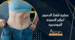 Read more about the article عملية شفط الدهون لعلاج السمنة الموضعية