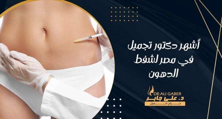 Read more about the article أشهر دكتور تجميل في مصر لشفط الدهون