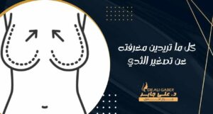 Read more about the article كل ما تريدين معرفته عن تصغير الثدي