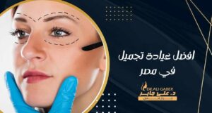 Read more about the article افضل عيادة تجميل في مصر