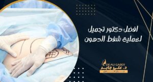 Read more about the article افضل دكتور تجميل لعملية شفط الدهون