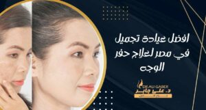 Read more about the article افضل عيادة تجميل في مصر لعلاج حفر الوجه