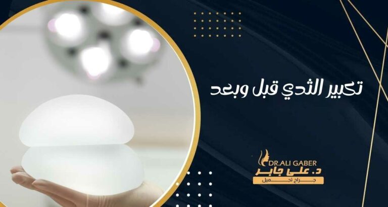 Read more about the article تكبير الثدي قبل وبعد