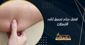 Read more about the article افضل جراح تجميل لشد الترهلات