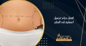 Read more about the article افضل جراح تجميل لعملية شد البطن