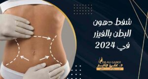Read more about the article شفط دهون البطن بالفيزر في 2024