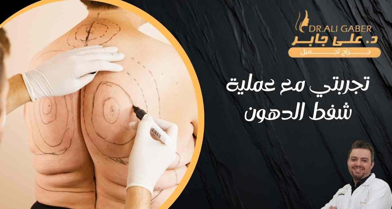 You are currently viewing تجربتي مع عملية شفط الدهون