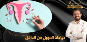 Read more about the article كل ما تريد معرفتة عن خياطة المهبل من الداخل